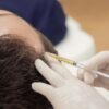 PLASMA RICO EN PLAQUETAS CAPILAR + VITAMINAS VELASH (COREANAS) - Imagen 2